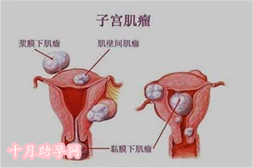 郑州试管助孕成功：一个充满希望的故事