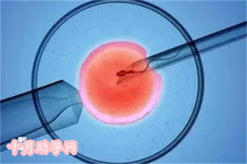 女人供卵试管：一种辅助生育技术