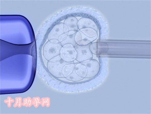 北京hiv试管受孕（艾滋病可以人工受孕吗）